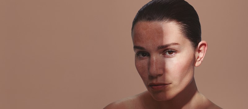 Pourquoi adopter une crème solaire anti-taches : Les bienfaits pour votre peau