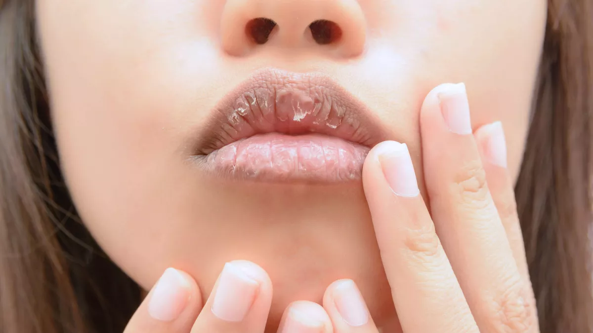 Comment Soigner des Lèvres Gercées et Douloureuses ?